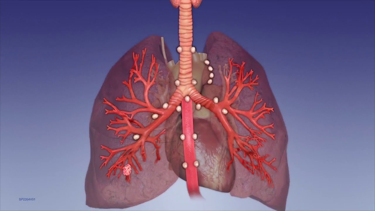 Lymph Node Anatomy-Olympus Bronchoscopy