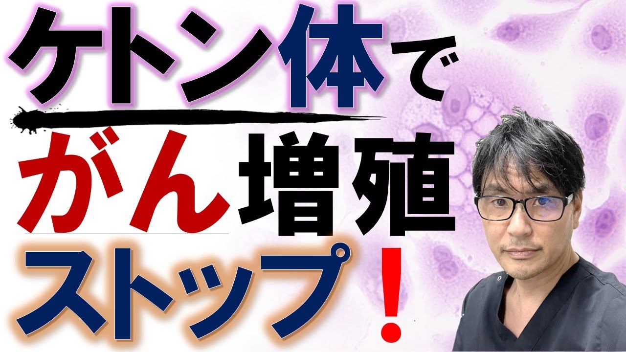 【最新研究】ケトン体でがんの増殖がストップ：糖質制限食による癌抑制の新たなメカニズムが解明
