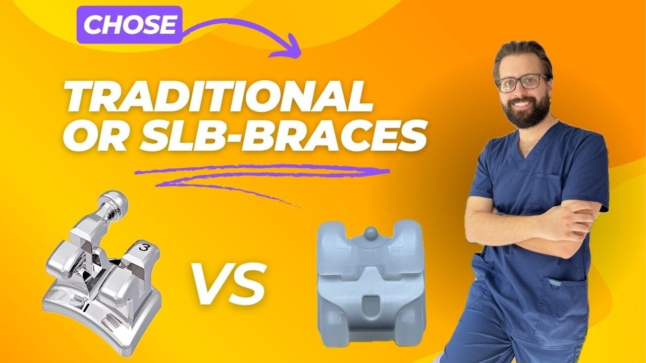 Choosing Your Braces: Classical vs. Self-Ligating