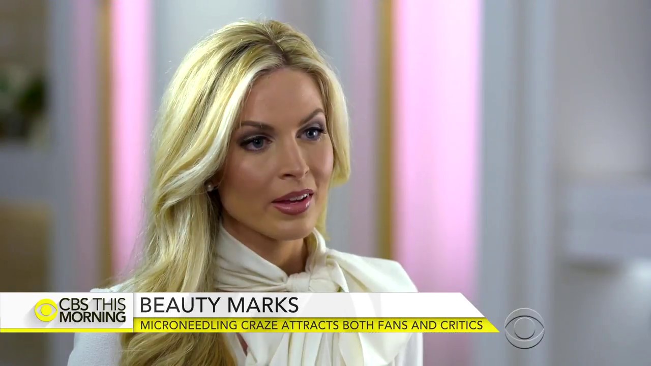 At-home microneedling tools attract fans and critics