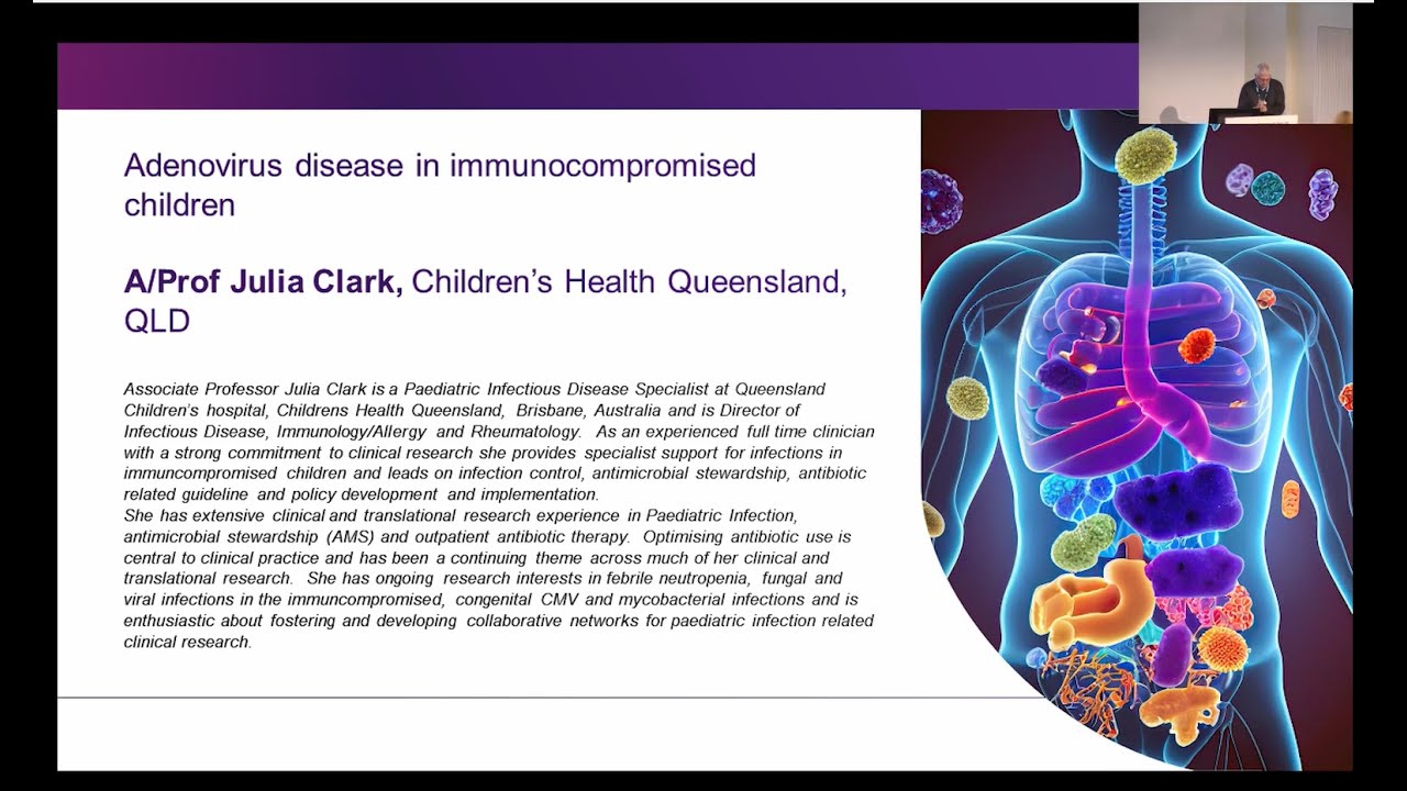 Adenovirus disease in immunocompromised children A/Prof Julia Clark