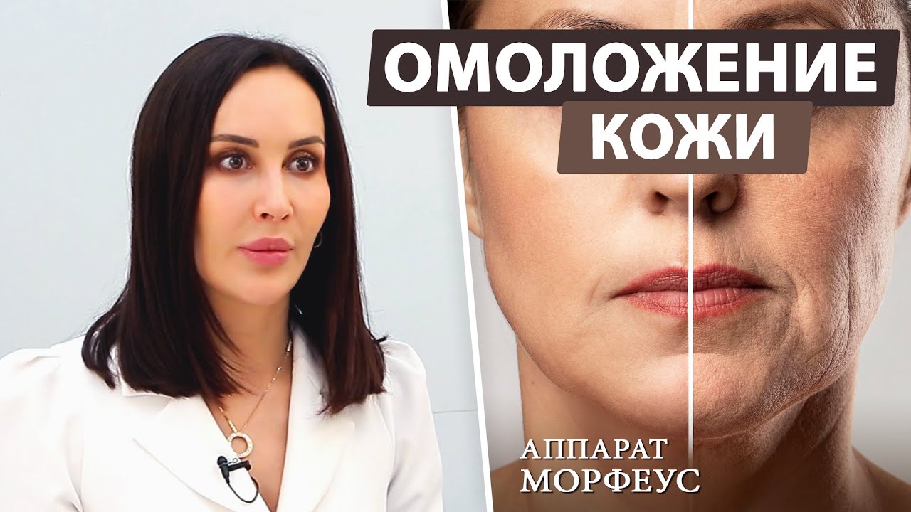 Почему именно RF лифтинг Morpheus? / Омоложение лица и Коррекция морщин