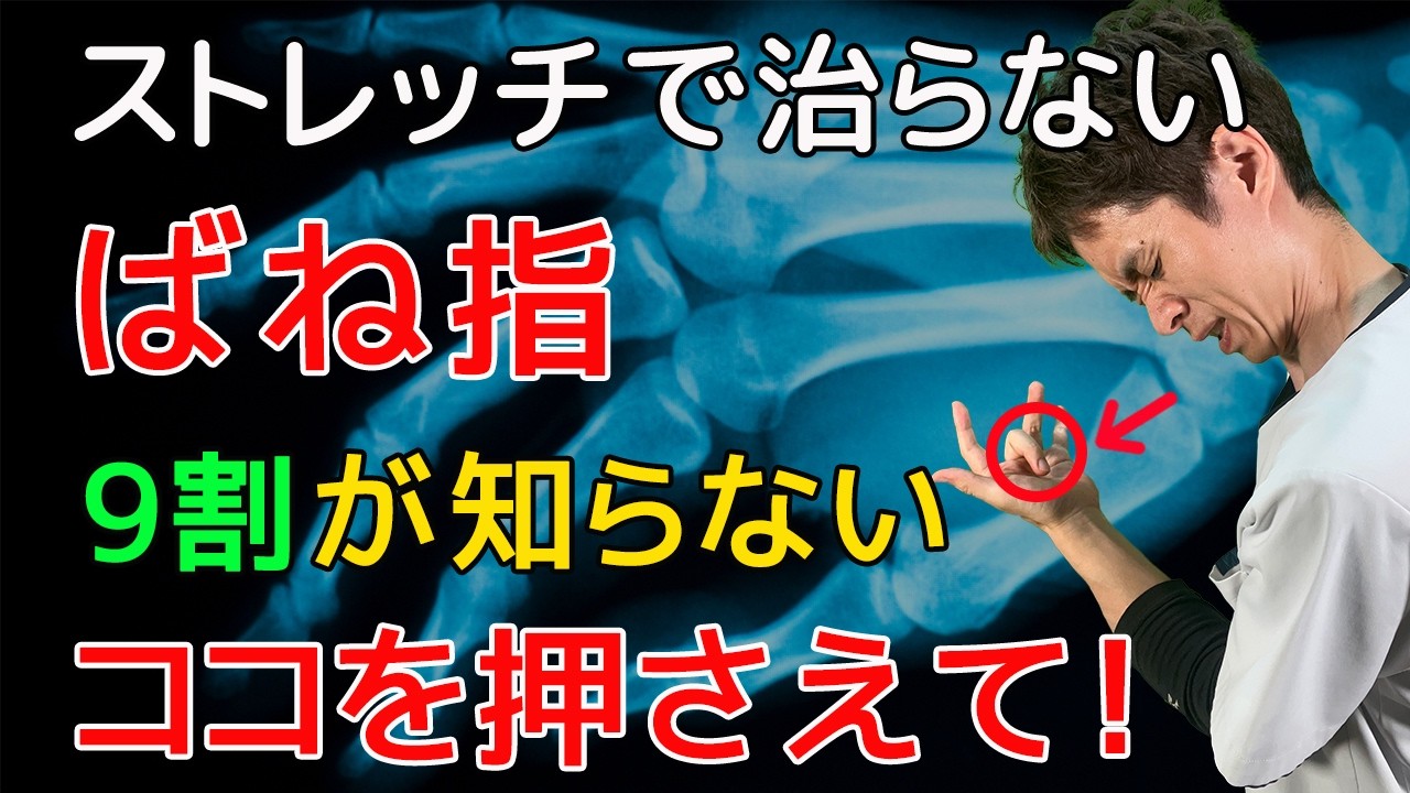 【バネ指 腱鞘炎】中指、薬指、親指のバネ指はココを押さえて徹底改善！【指の痛み治し方】