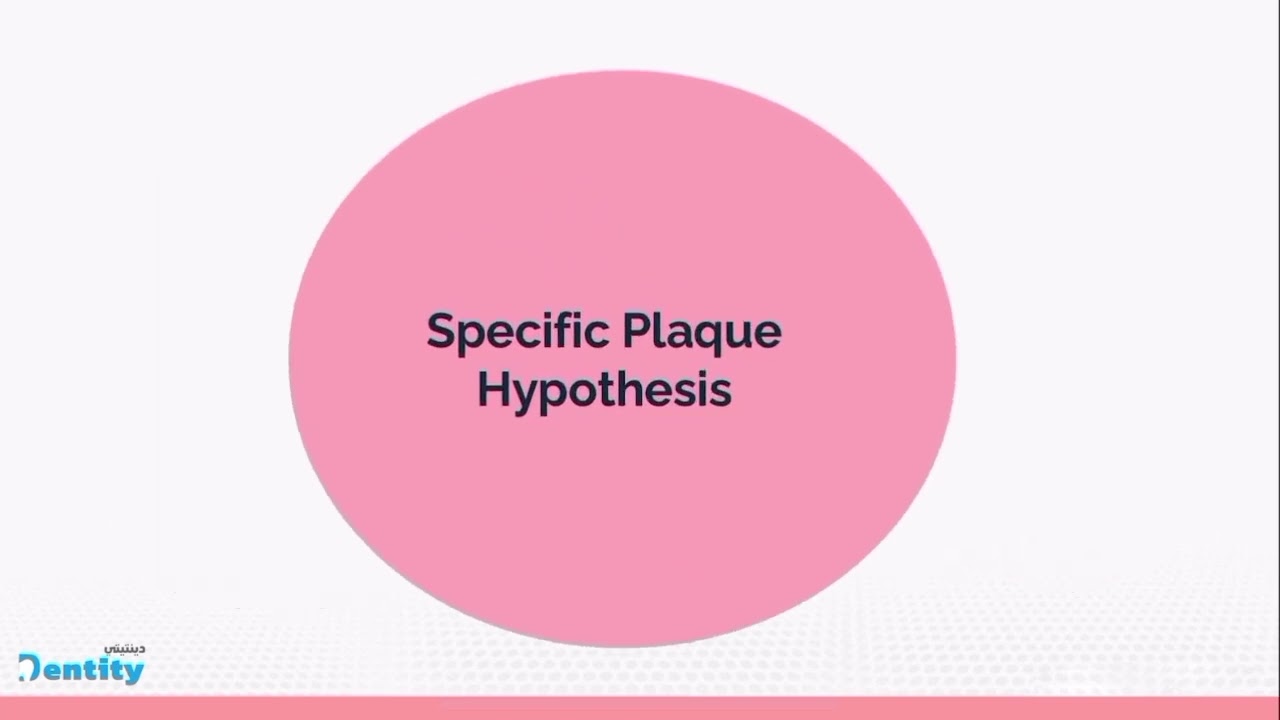 periodontology  4th stage   plaque hypothesises