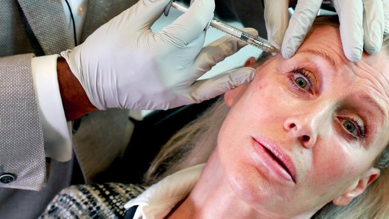Angie Best My Liquid Facelift: Is It Worth It? Am I Happy?