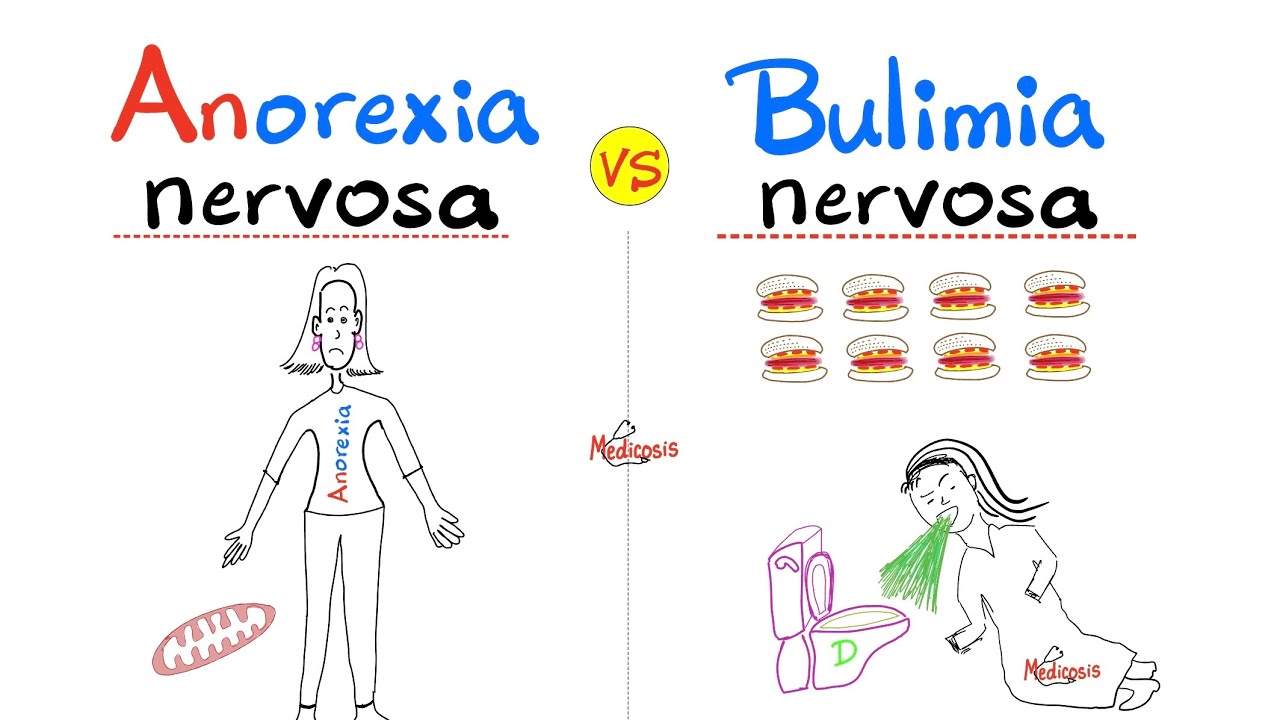 Anorexia Nervosa vs. Bulimia Nervosa - Eating Disorders - Psychology and Psychiatry - DSM 5