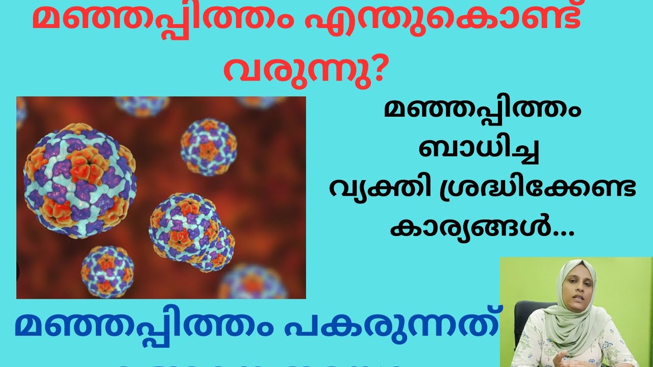 മഞ്ഞപ്പിത്തം പകരുന്നത് എങ്ങനെ തടയാം? മഞ്ഞപ്പിത്തം ബാധിച്ചവർ ശ്രദ്ധിക്കേണ്ട കാര്യങ്ങൾ.