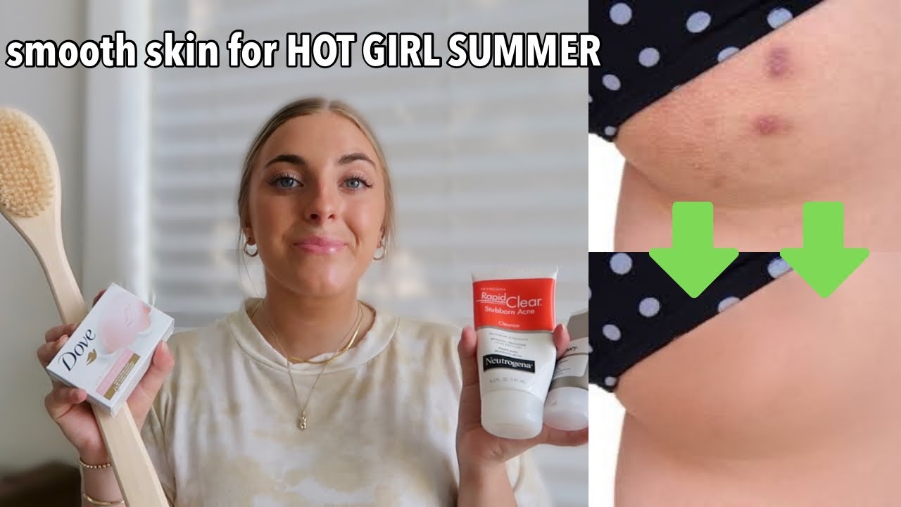 How I Got Rid Of Bum Acne (Folliculitis): beach bikini body skin care routine for *hot girl summer*