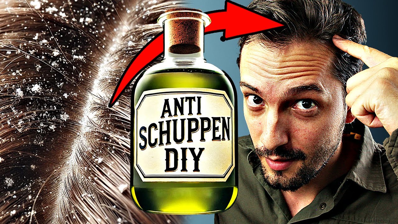 Effektives Anti-Schuppen-Mittel aus heimischen Pflanzen herstellen