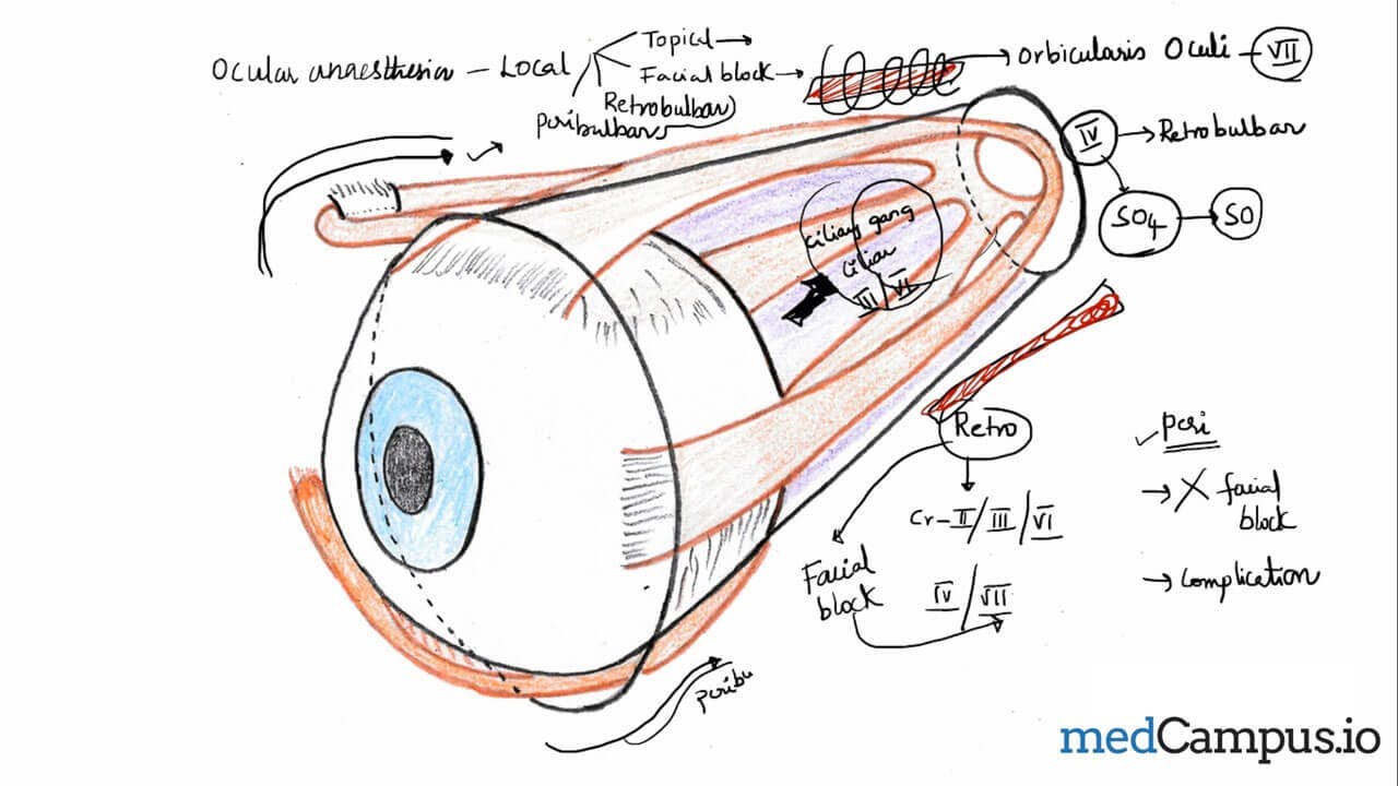 Peribulbar block vs retrobulbar block | Ocular anesthesia | Ophthalmology| medcampus