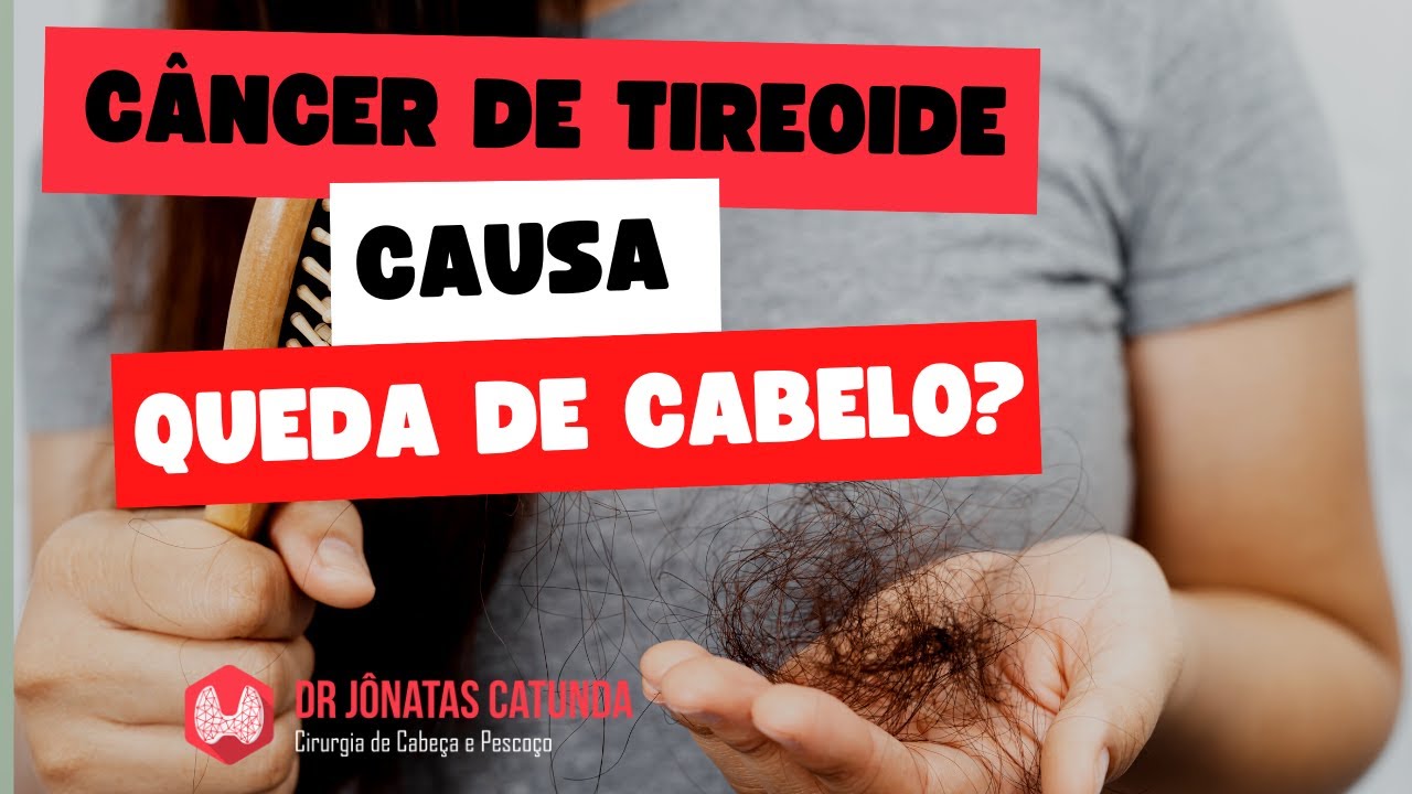 Câncer de tireoide causa queda de cabelo?