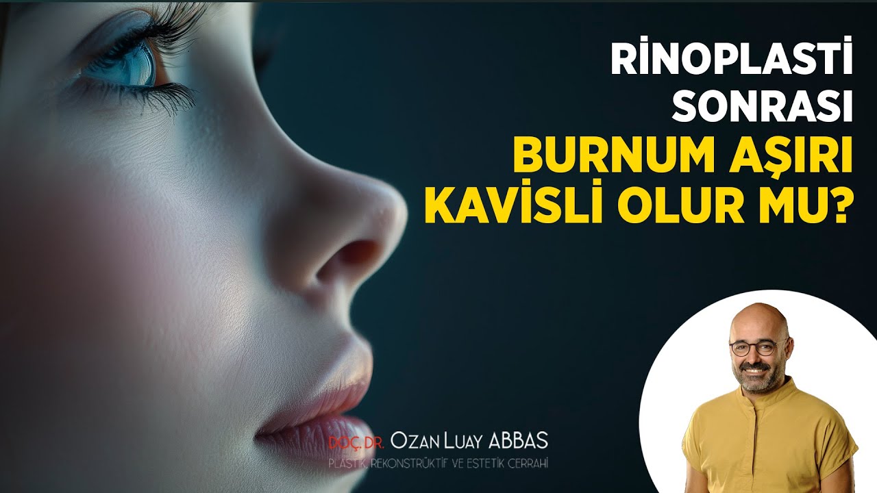 Rinoplasti Sonrası Burnum Aşırı Kavisli (Kaydırak gibi) Olur mu? | Doç.Dr. Ozan Luay ABBAS