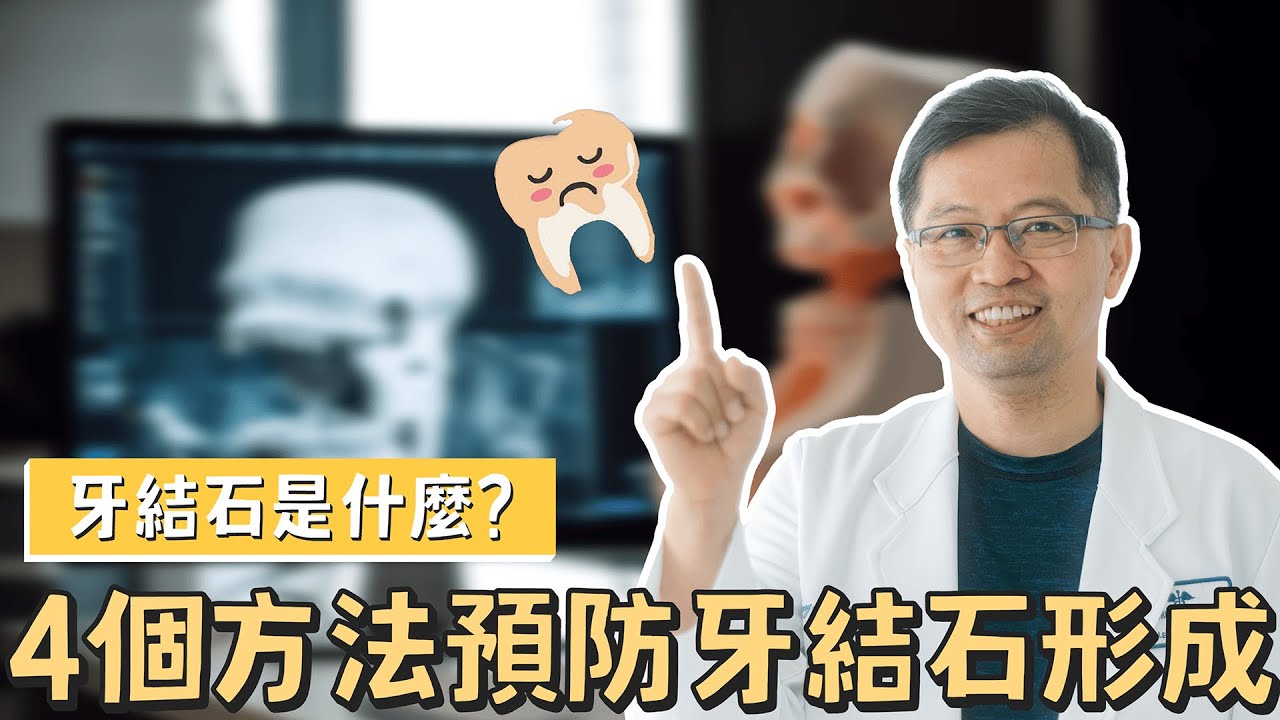 牙結石是什麼？4個方法預防牙結石形成🦷