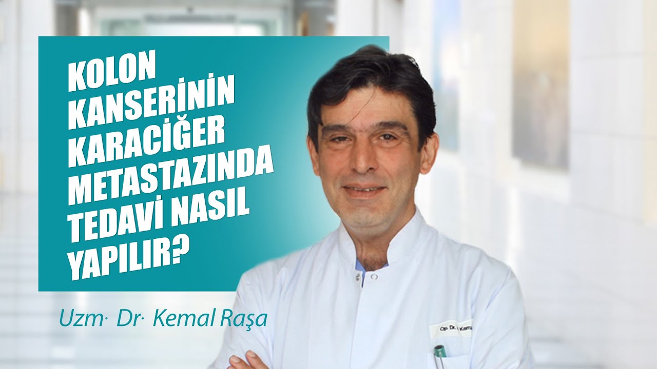 Kolon kanserinin karaciğer metastazında tedavi nasıl yapılır? - Uzm. Dr. Kemal Raşa