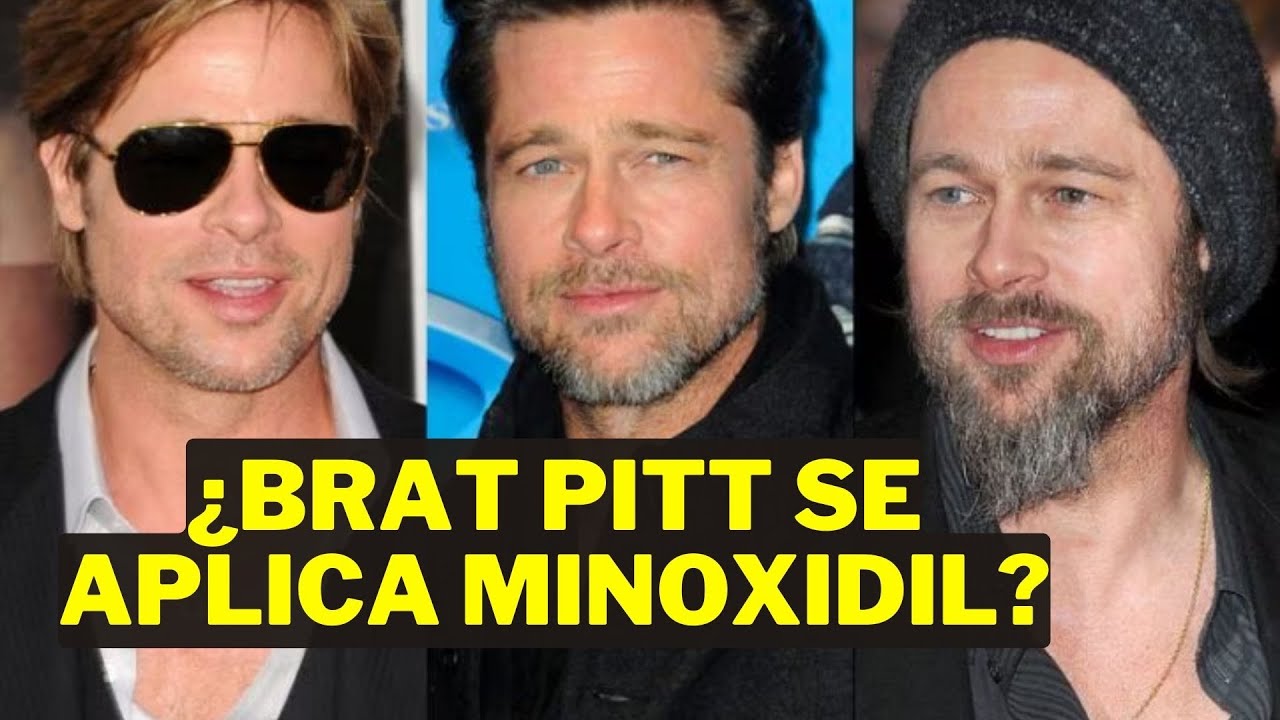 Barba al Estilo Brad Pitt: ¡El SECRETO Revelado! 👉 ¿Minoxidil?