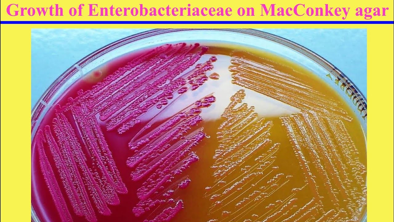 فكرة وإستخدام الماكونجى أجار Principle and Uses of MacConkey’s Agar