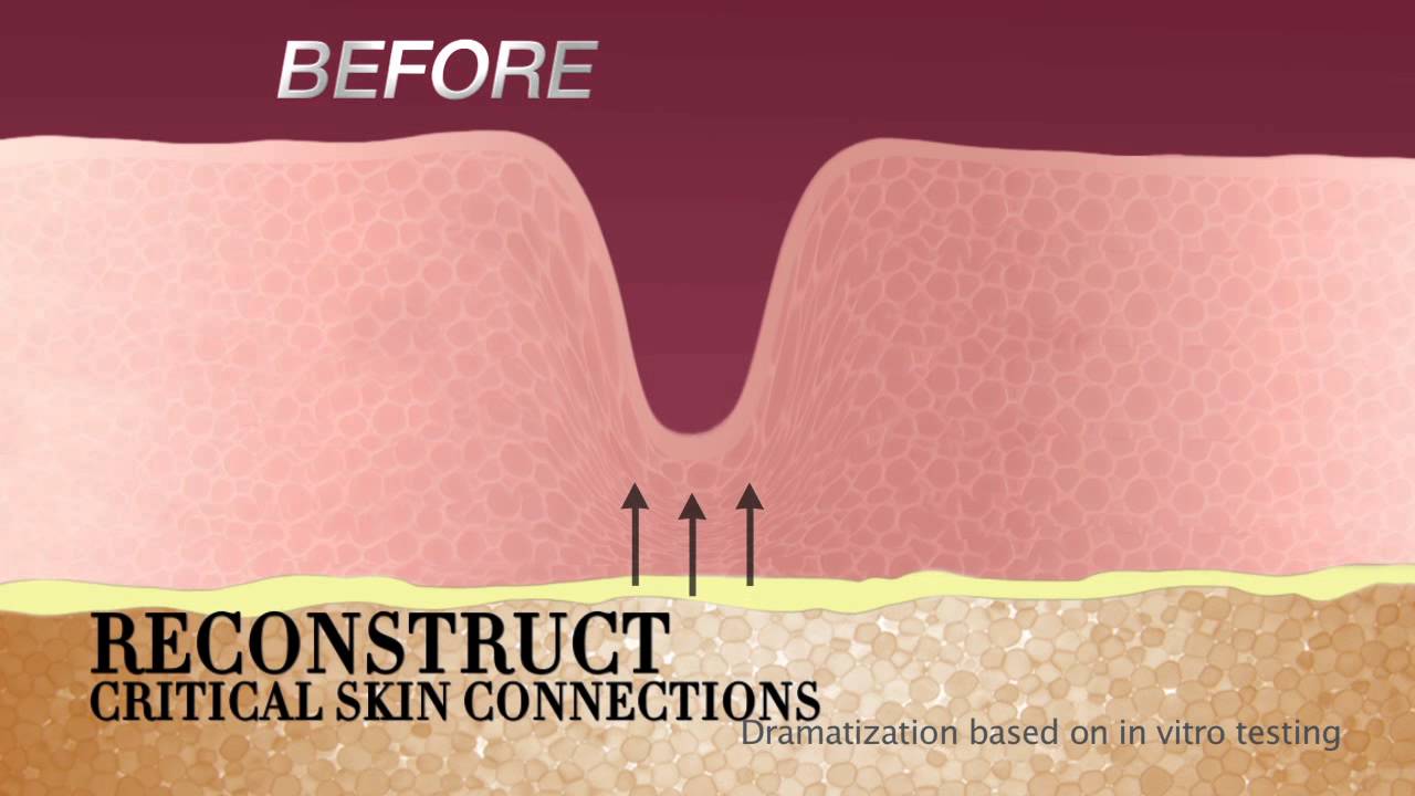 ANEW Reversalist Complete Renewal Express*