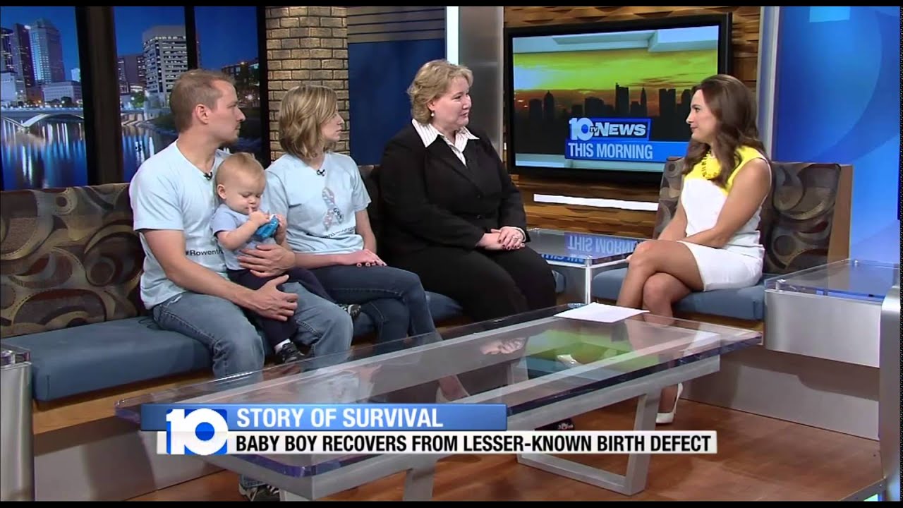 Rare Birth Defects