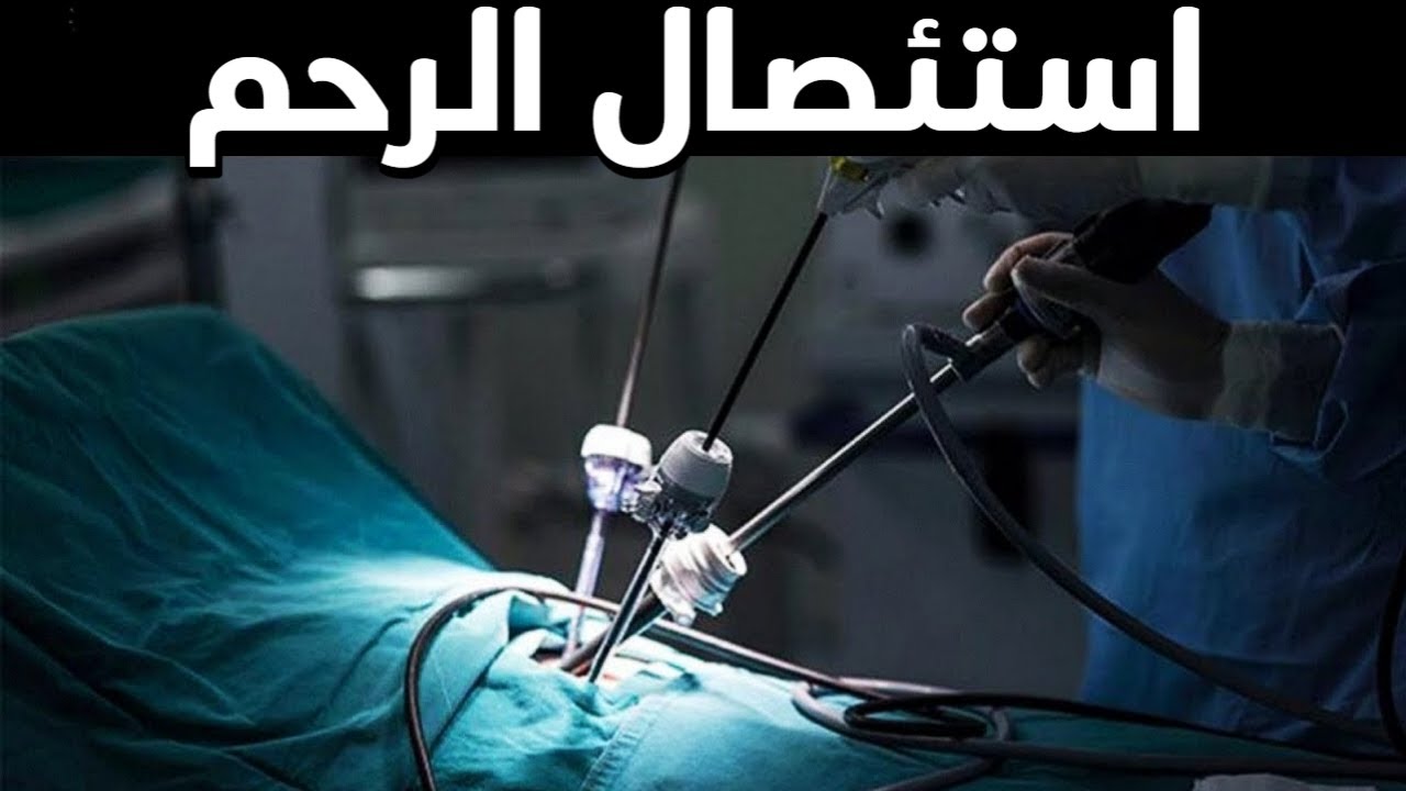 استئصال الرحم | أهم نصيحة قبل وبعد ازالة الرحم أو المبايض