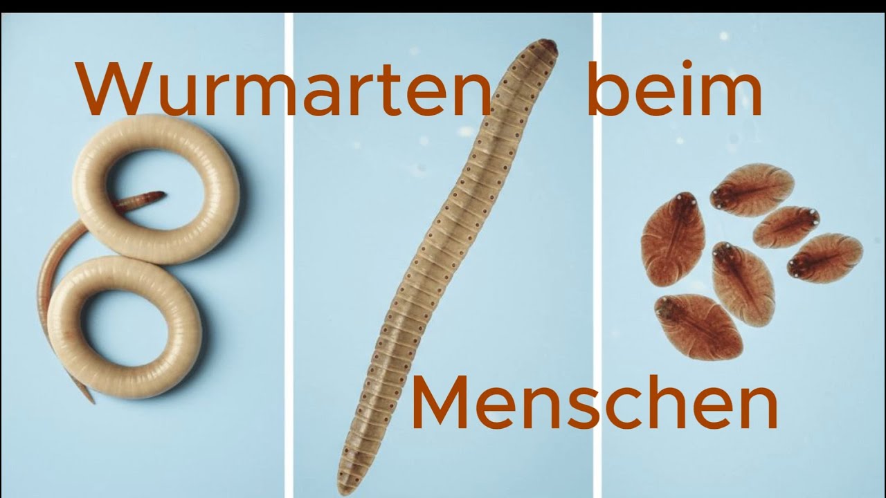 Wurmarten beim Menschen