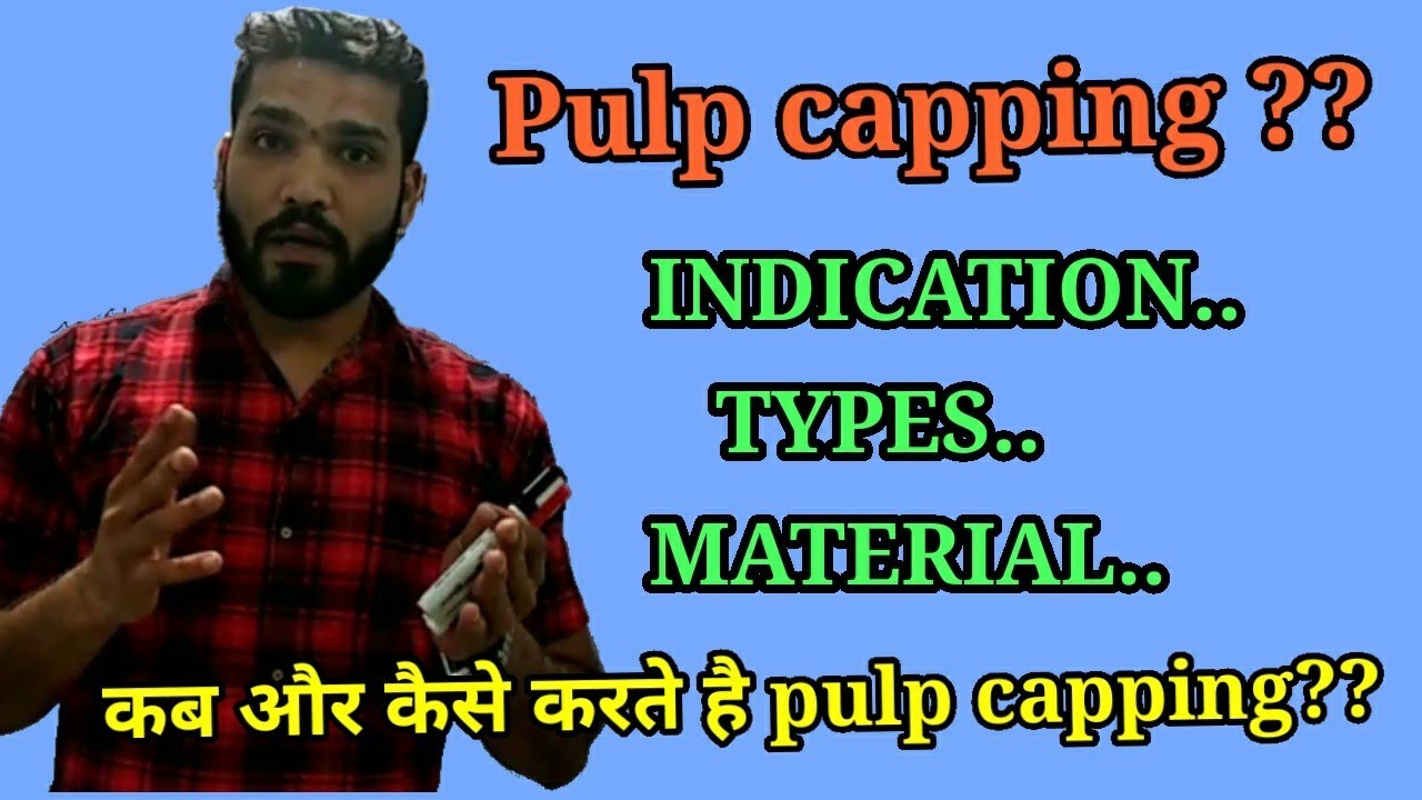 Pulp capping, types, material ,indications | How to do direct & indirect pulp capping?