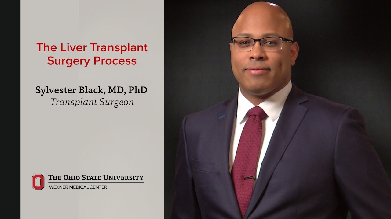 The liver transplant surgery process | Ohio State Medical Center