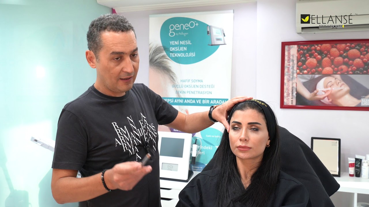 Ellanse Akıllı Dolgu Hangi Bölgelere Uygulanabilir?