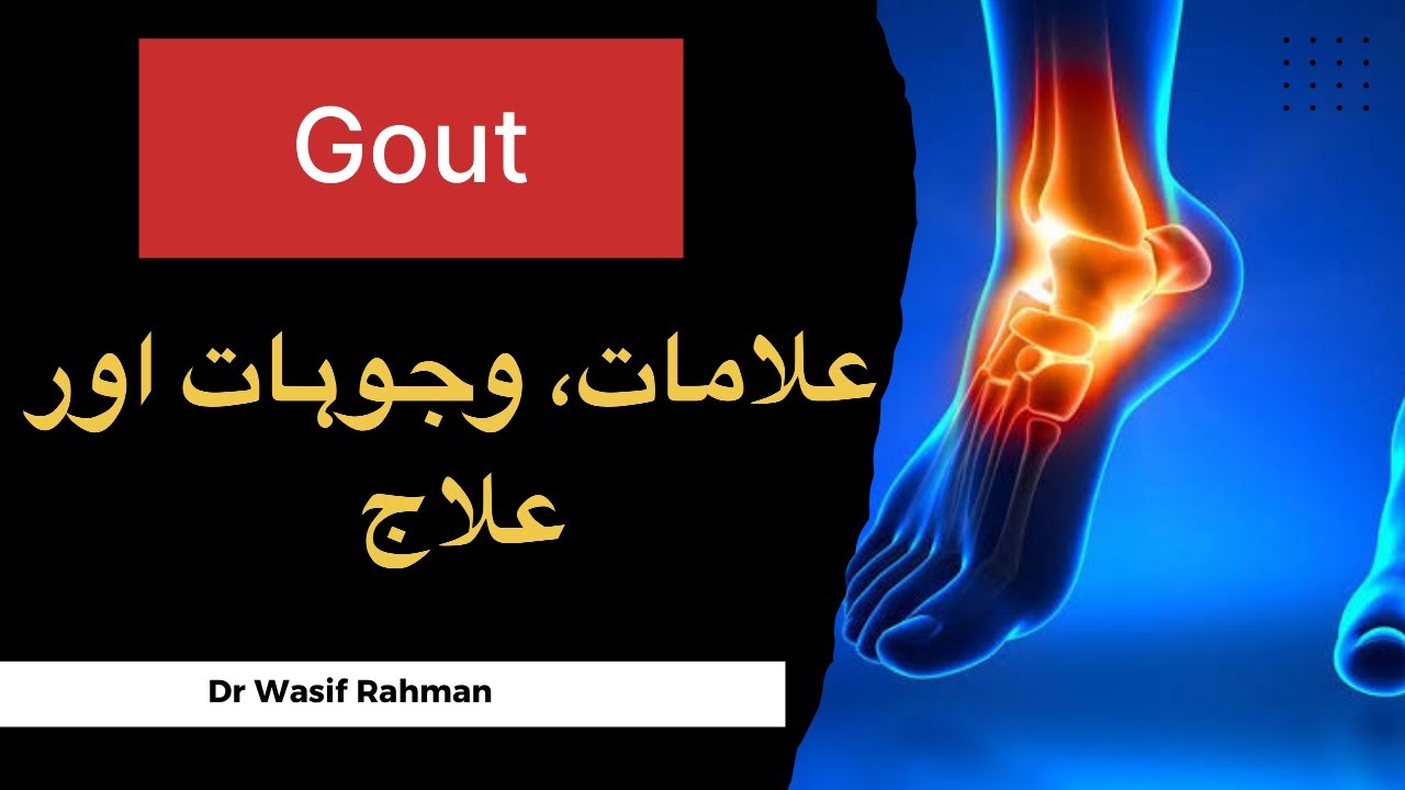 Gout | Causes | Treatment | Dr Wasif Rahman