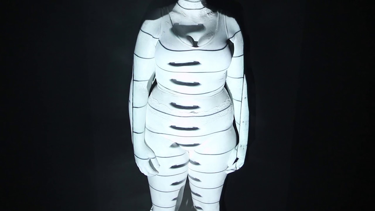 I Am a Zebra  Hypermobility and Invisible Disabilities
