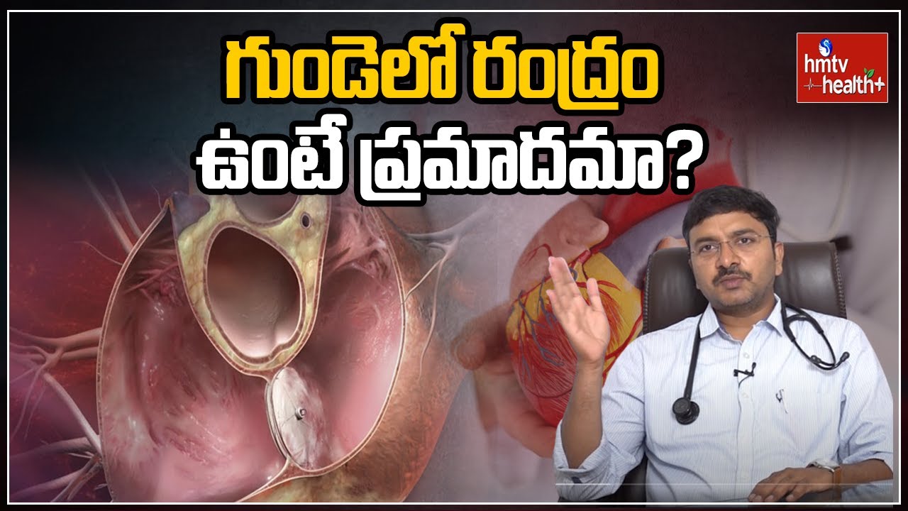 గుండెలో రంద్రం ఉంటే ప్రమాదమా? l Hole in the heart l hmtv Health