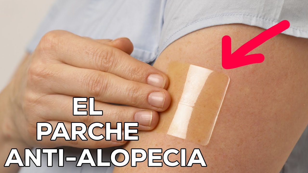 AVANCE M&Eacute;DICO: el PARCHE para la CALVICI