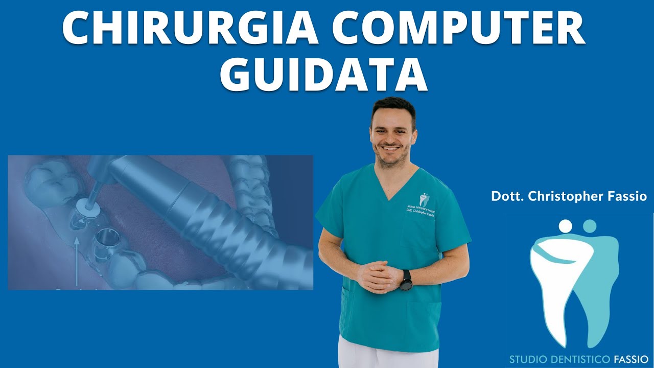 Chirurgia computer guidata mini-invasiva per impianti dentali