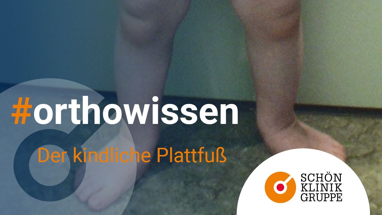 Wissensforum Orthopädie: Der kindliche Plattfuß | Schön Klinik München Harlaching