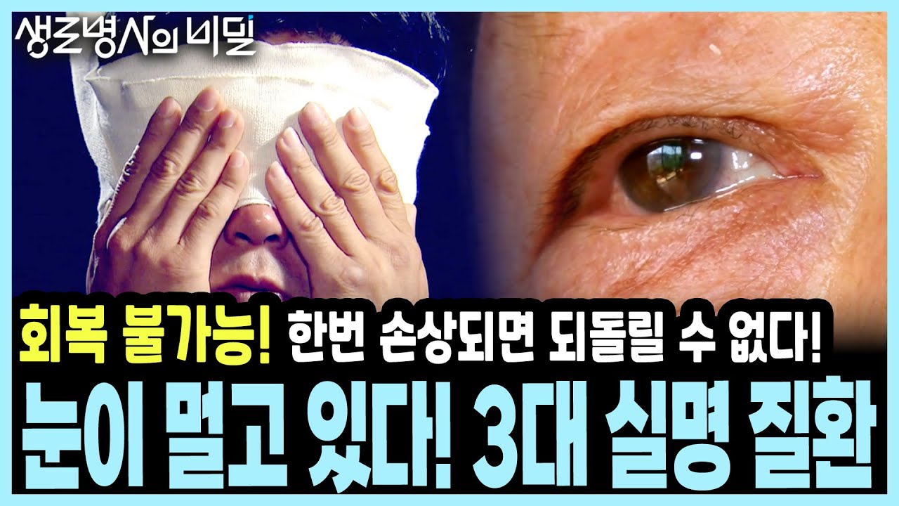 [눈 건강 경고] 한번 잃으면 끝! 소리 없이 다가와 실명시키는 '3대 안질환'의 치명적 경고! I KBS 20140924 방송