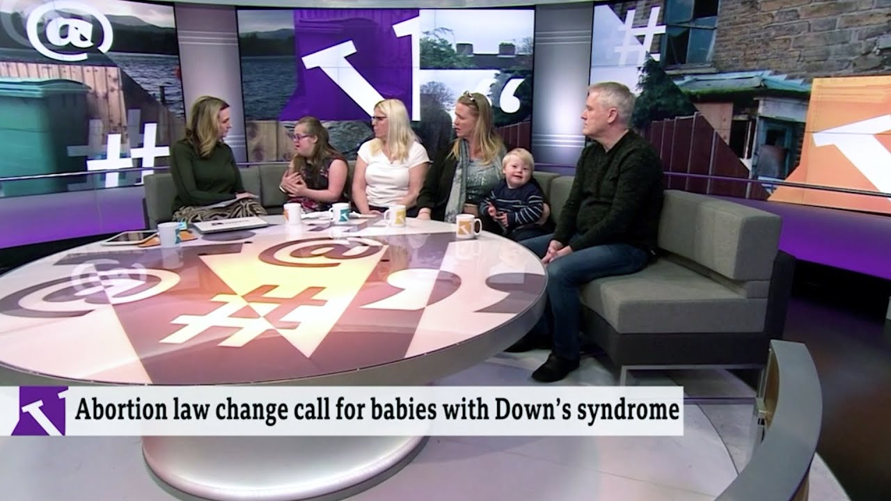 Down's syndrome campaigners call for change to abortion law