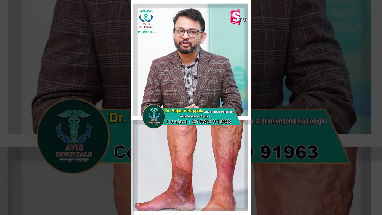 Avis Vascular Centre #avis #varicoseveinstreatment #varicose #vascularcentre #avishospital