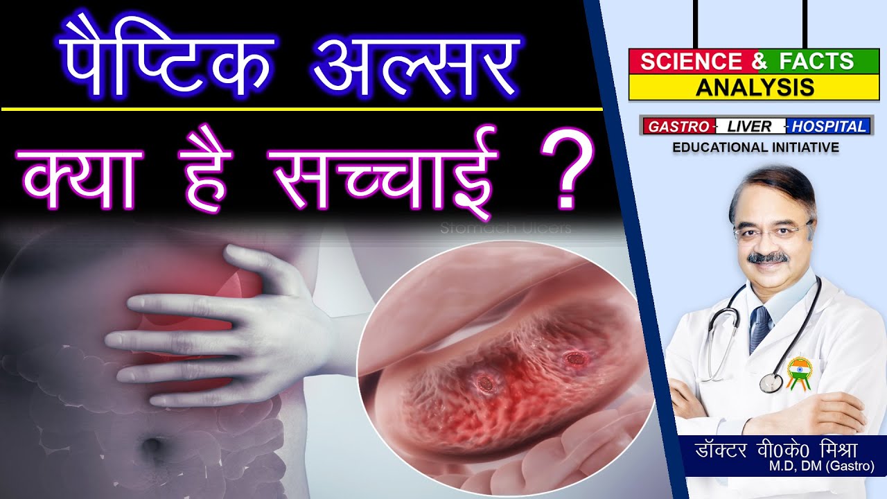 पैप्टिक अलसर क्या है सच्चाई ? || PEPTIC ULCER DISEASE