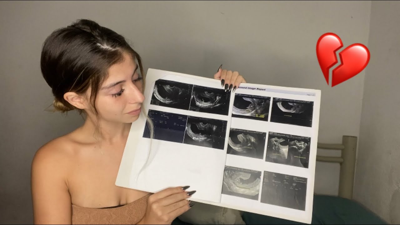 MINHA SEGUNDA GRAVIDEZ (SOFRI UM ABORTO)