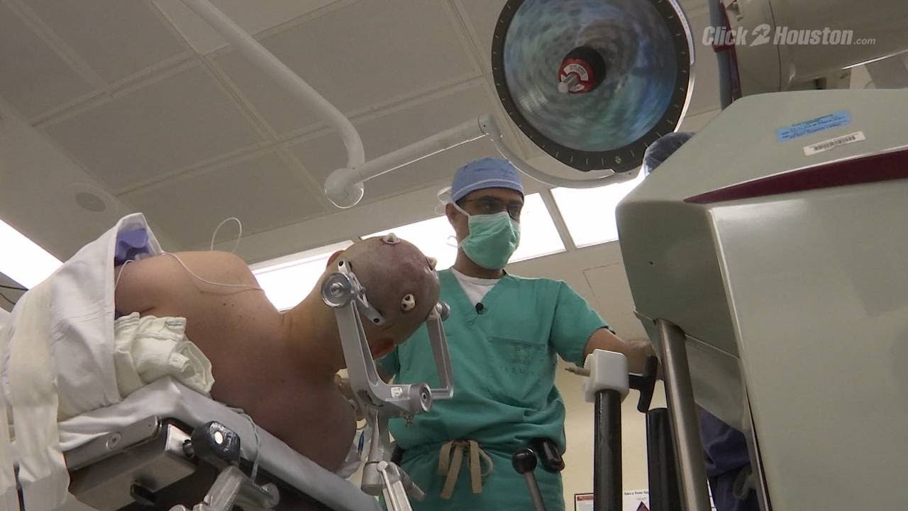 Epilepsy surgery can stop seizures