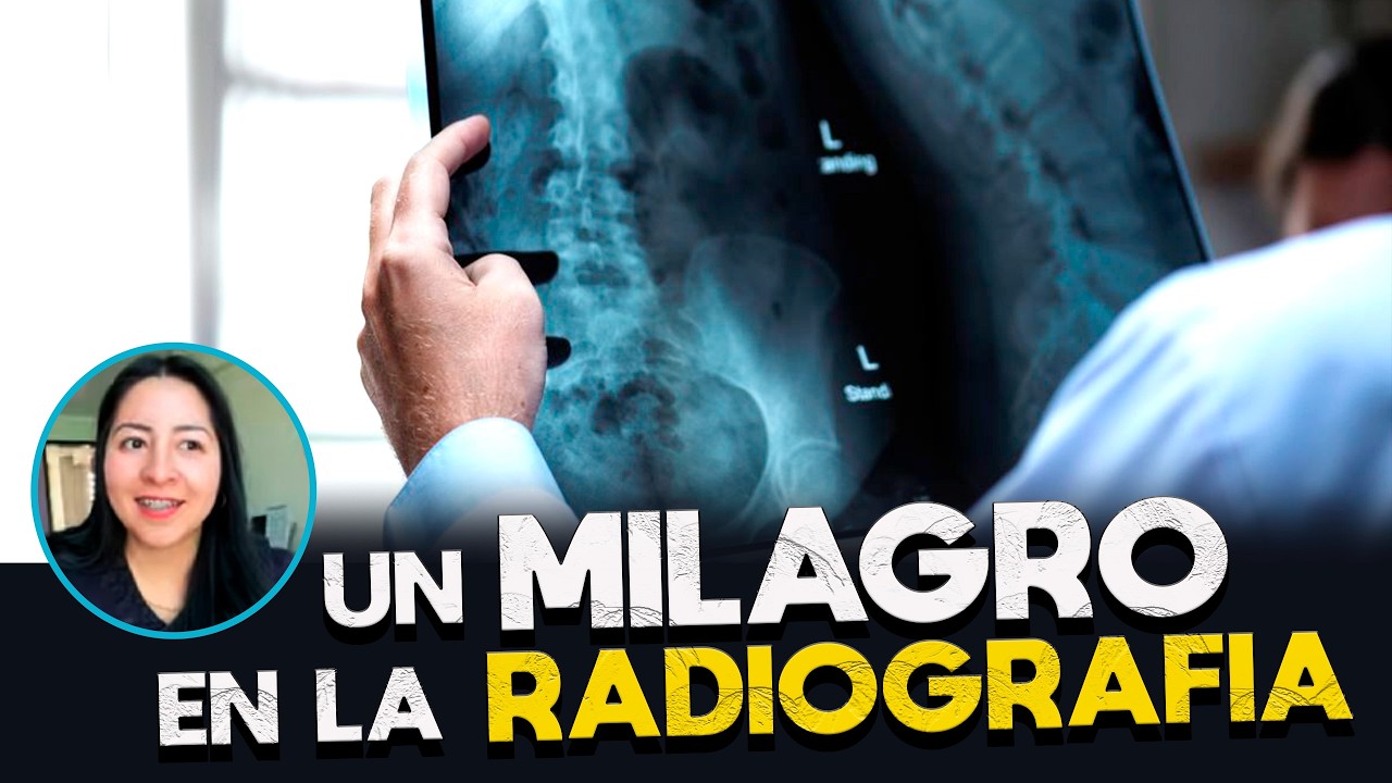 Cancelaron la cirugía por lo que apareció en la radiografía. Testimonio Impactante