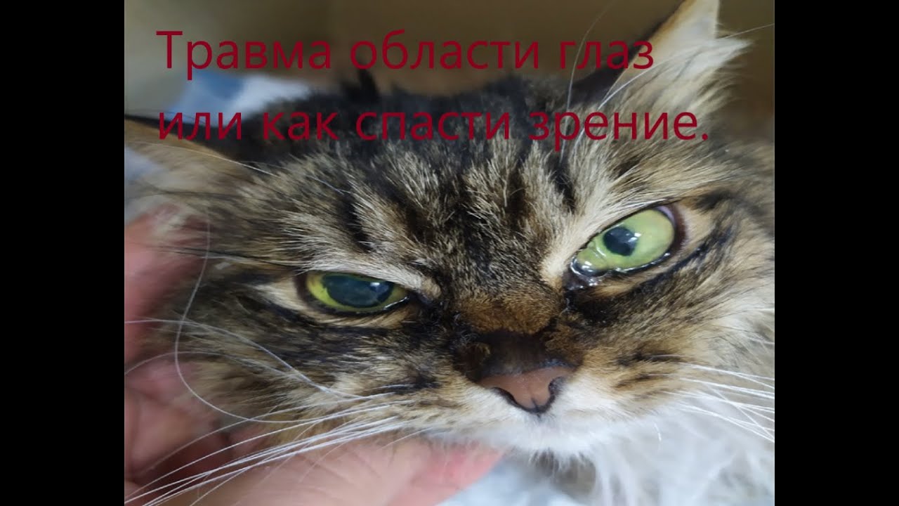 Травмы области глаз или как спасти зрение.