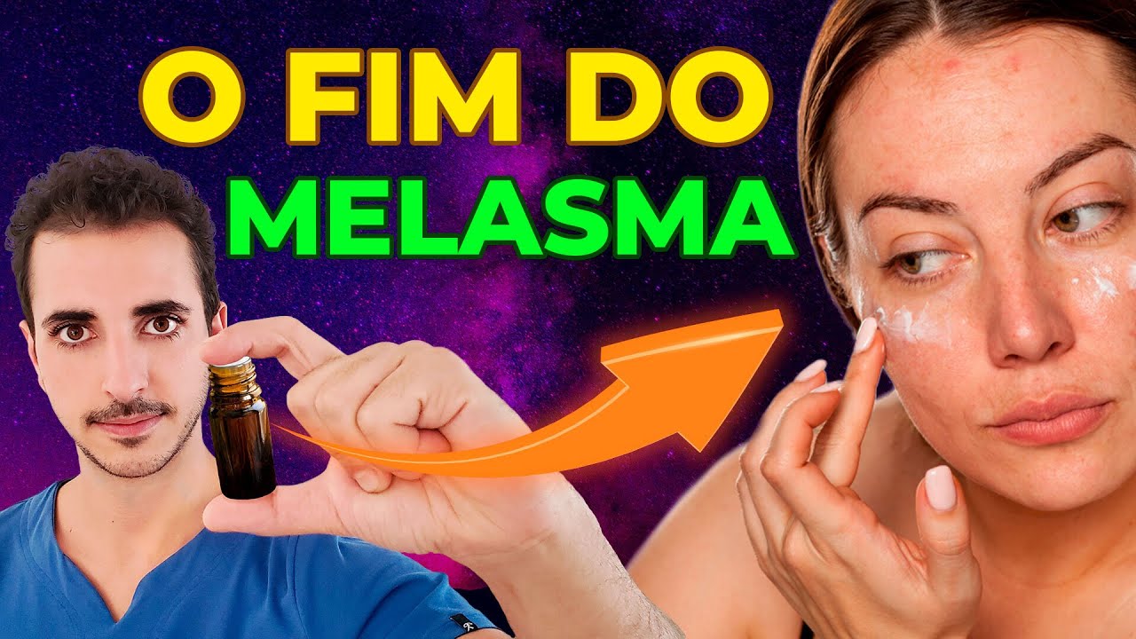 O FIM DO MELASMA