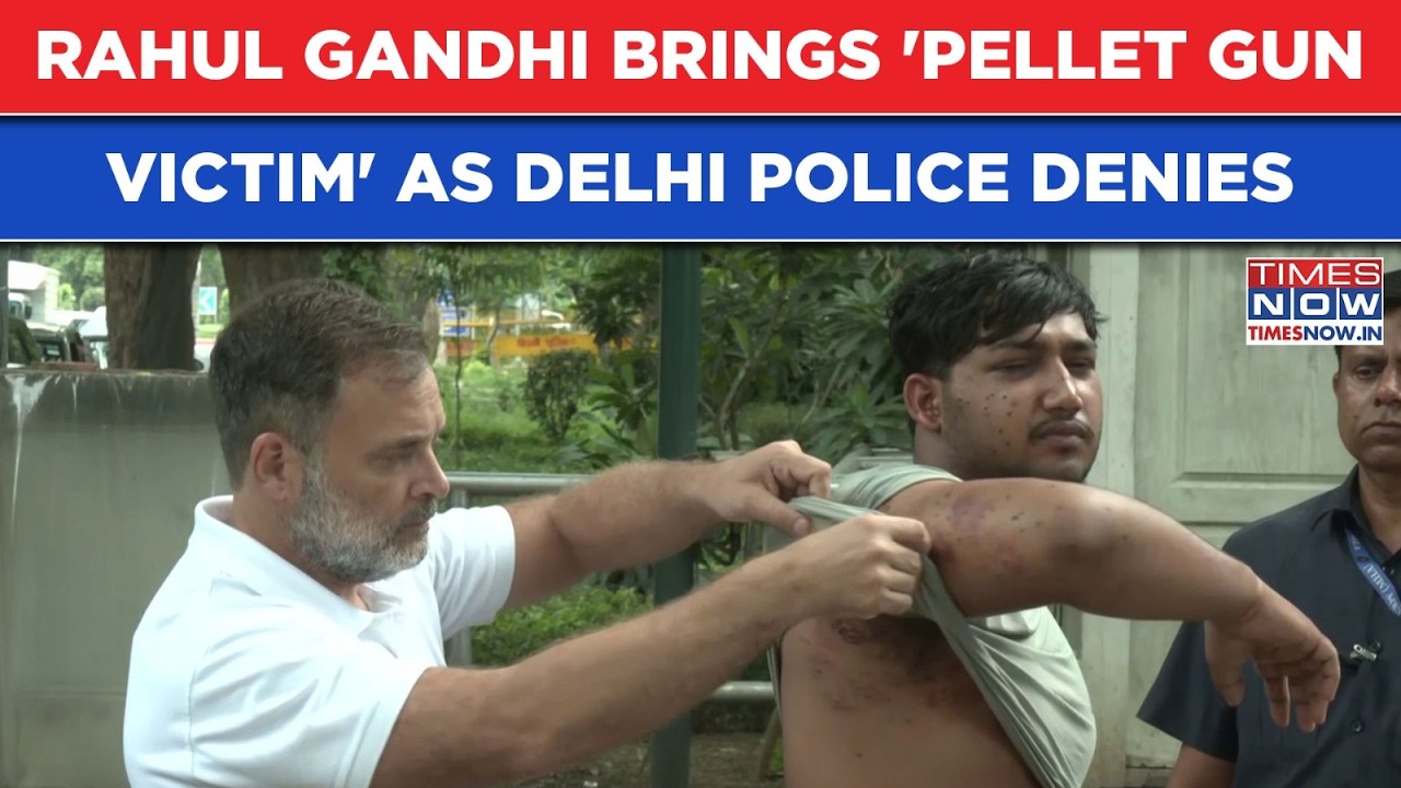 Rahul Gandhi Brings 'Pellet Gun Victim' From CJP's Delhi Protest Horror As Police Denies: Watch