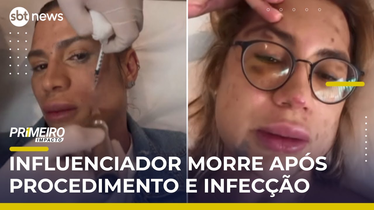 Influenciador morre após complicações de procedimento estético no rosto | #PrimeiroImpacto