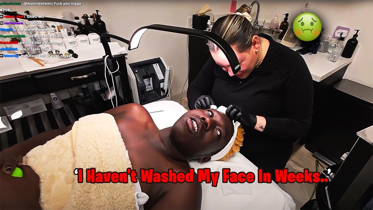 emannn3x Reacts To Dabo's Face Surgery...