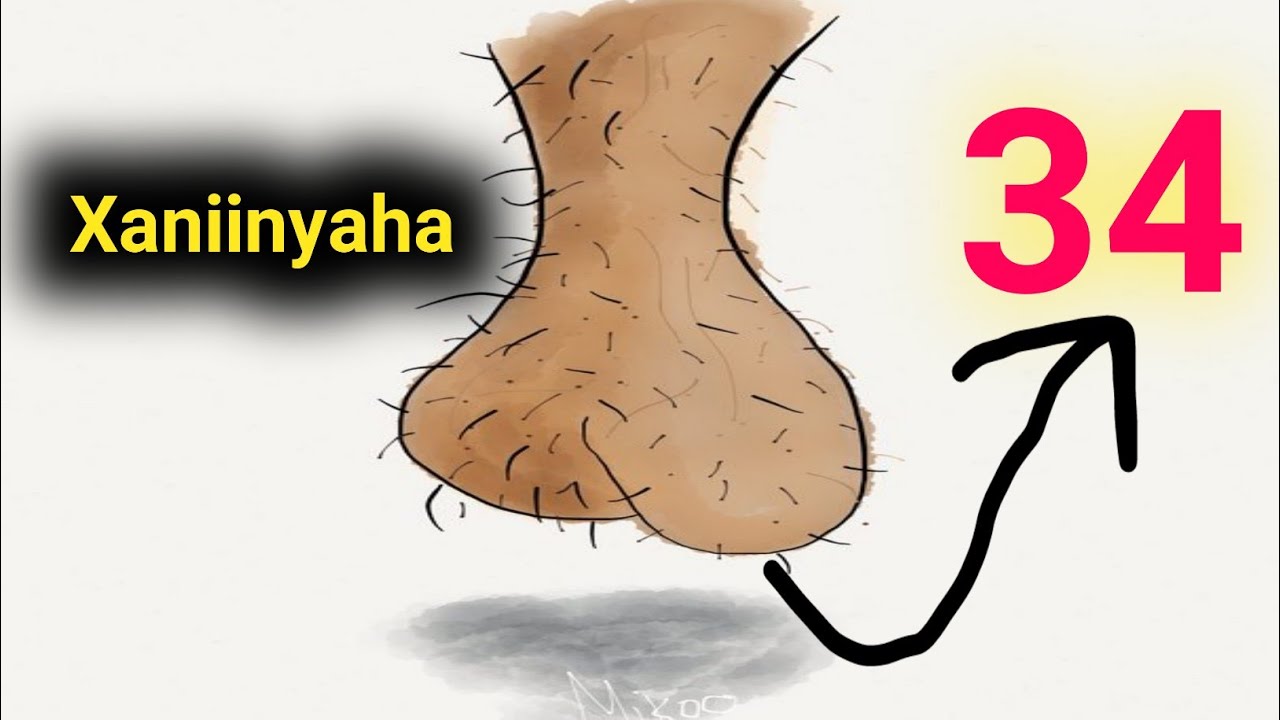 5- qalad oo xaniinyaha iyo shahwada wax yeeleeyso hadii aa sameeyso.........