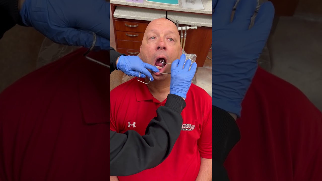 Intra oral photos