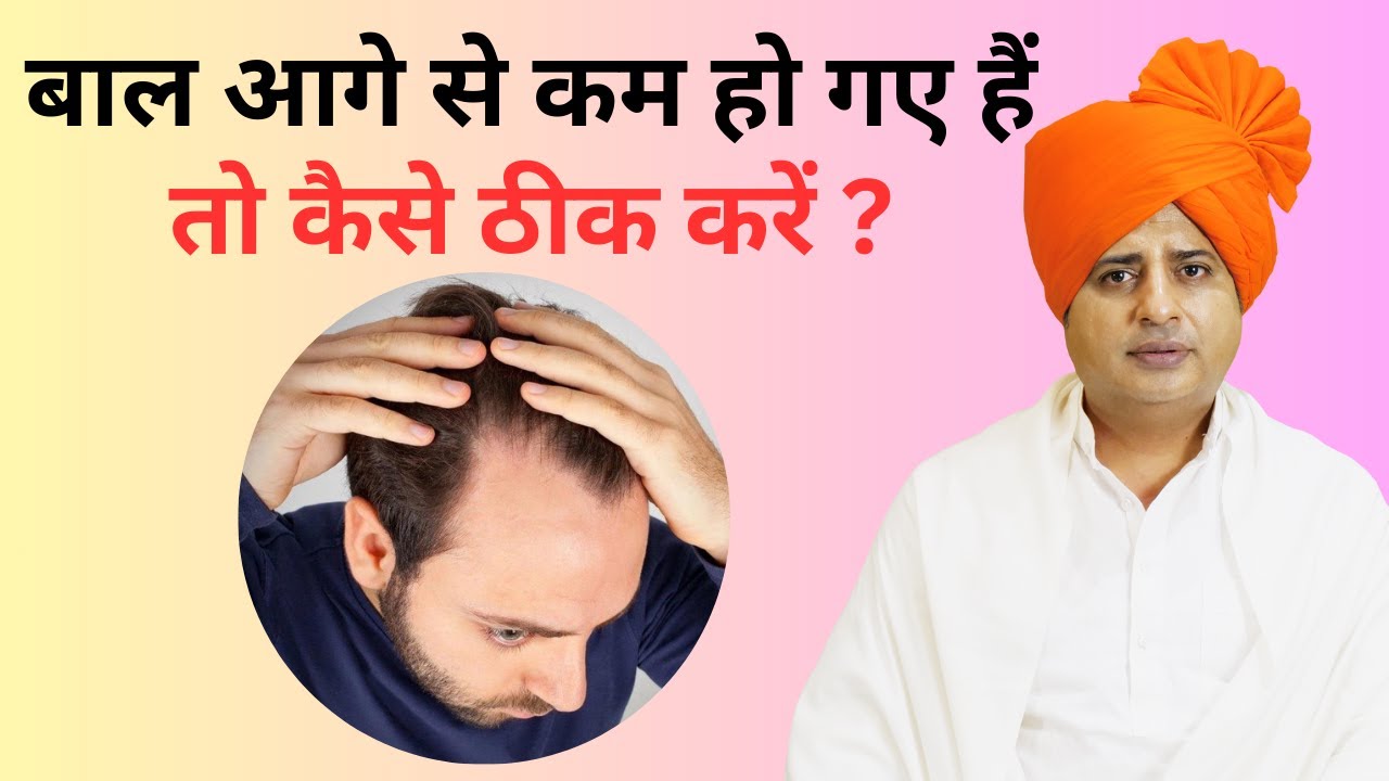 बाल आगे से कम हो गए है तो कैसे ठीक करें ? || Sanyasi Ayurveda ||