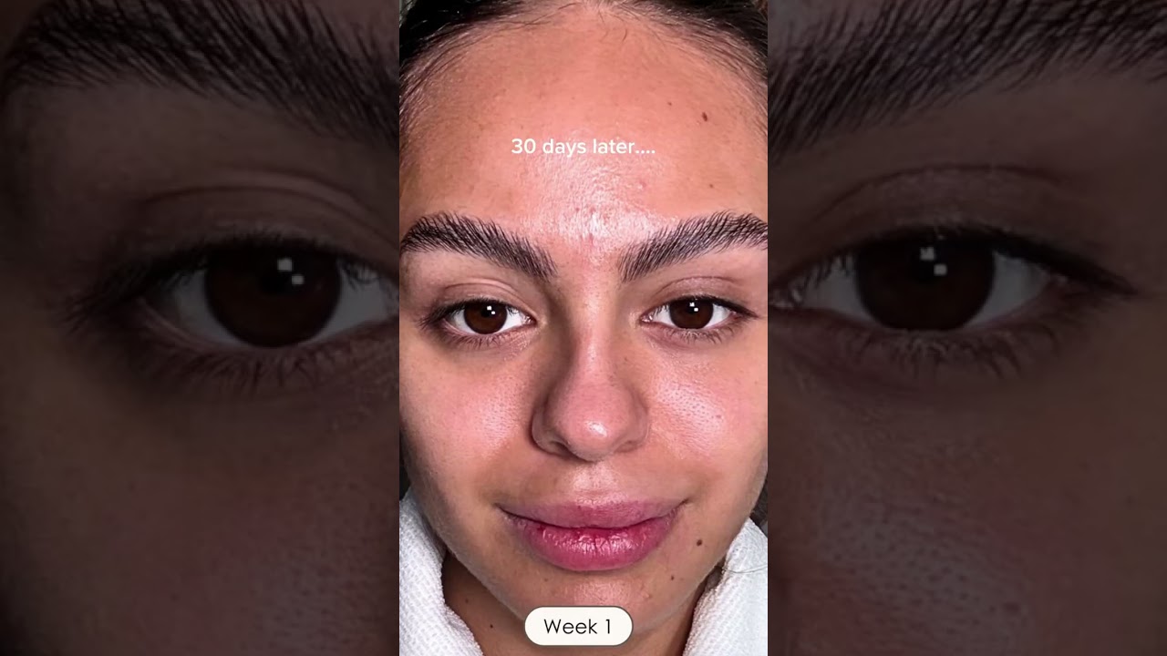 Ever heard of the 30-day red light therapy skin reset? 🧖&zwj;♀️