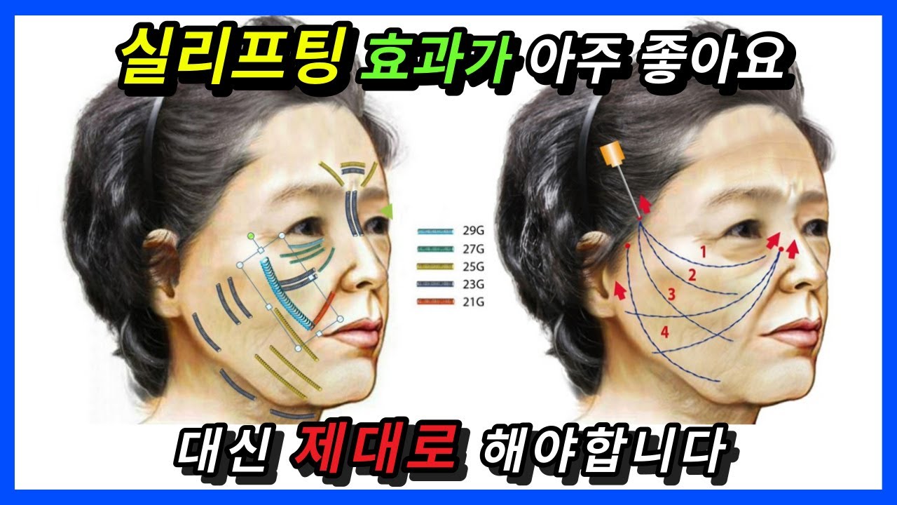 실리프팅 효과가 아주 좋아요! 대신 제대로 해야합니다 #실리프팅